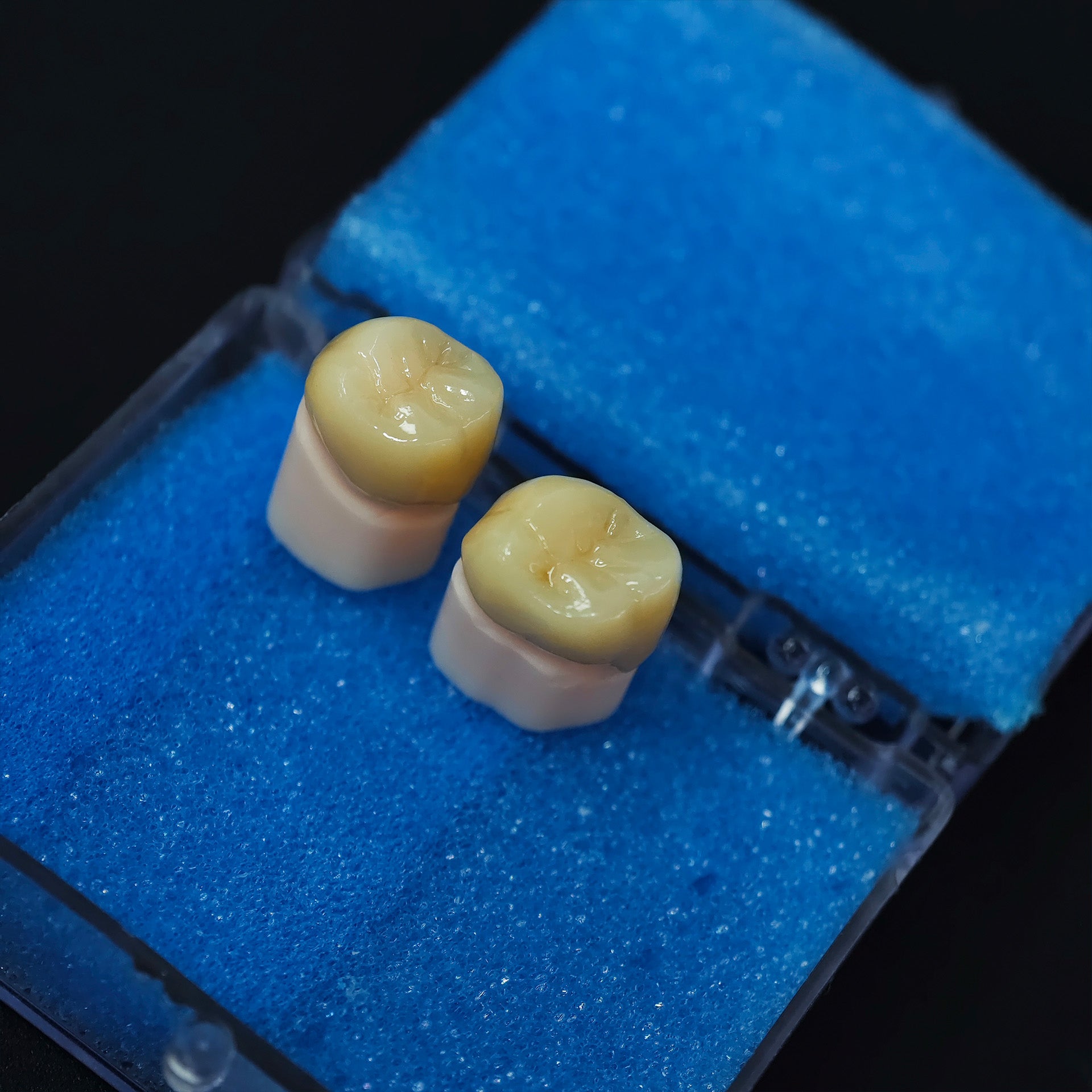 High - Strength Zirconia Crowns