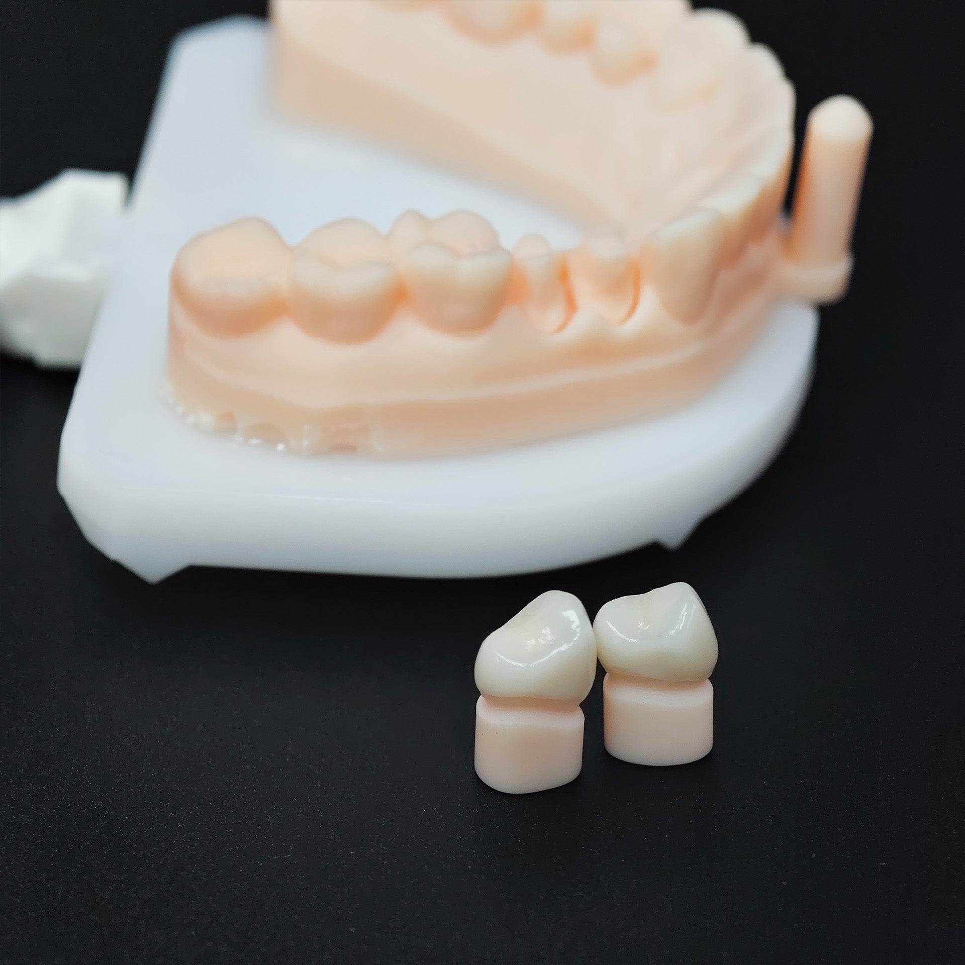 High - Strength Zirconia Crowns