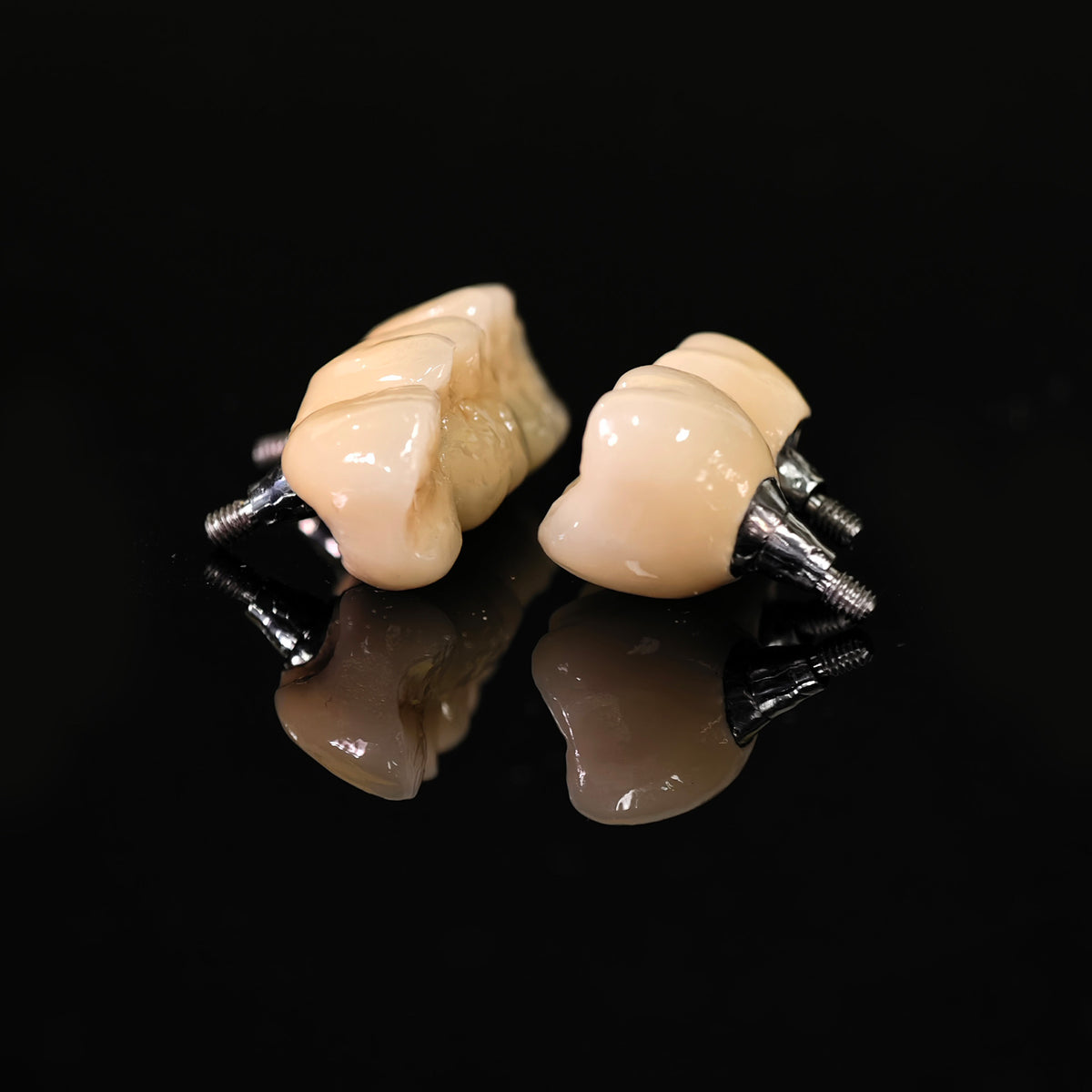 Implant-supported Co - Cr PFM Dental Bridge