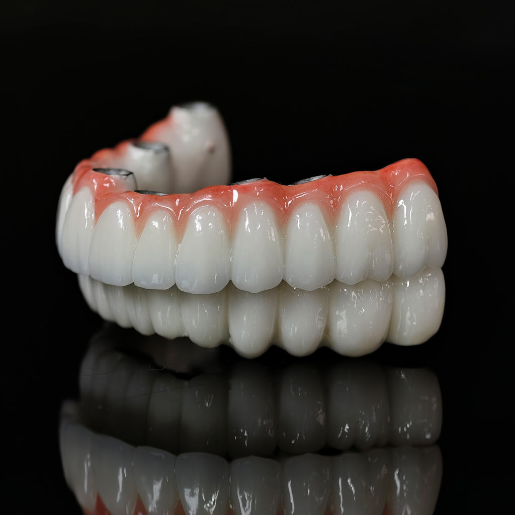 Implant-supported Co - Cr PFM Dental Bridge