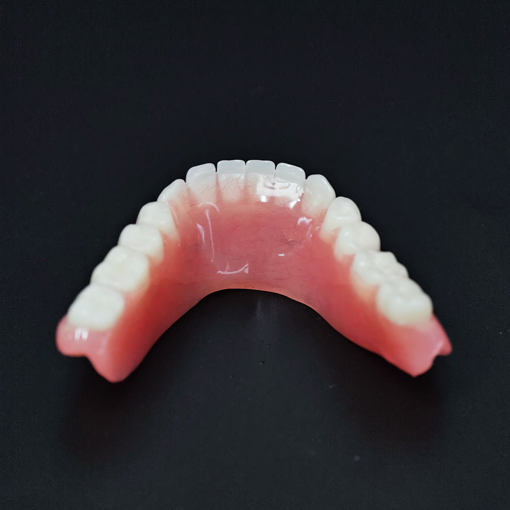 Locator Overdenture Implant Acrylic Denture Restoration