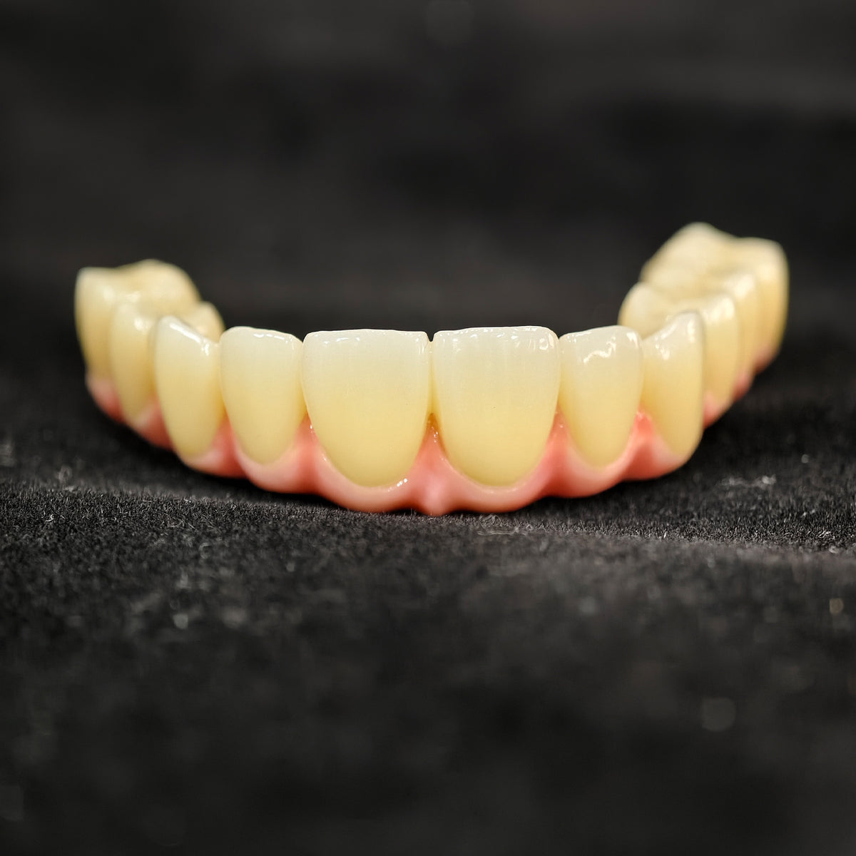Malo Bridge With Exposed Titanium Framework