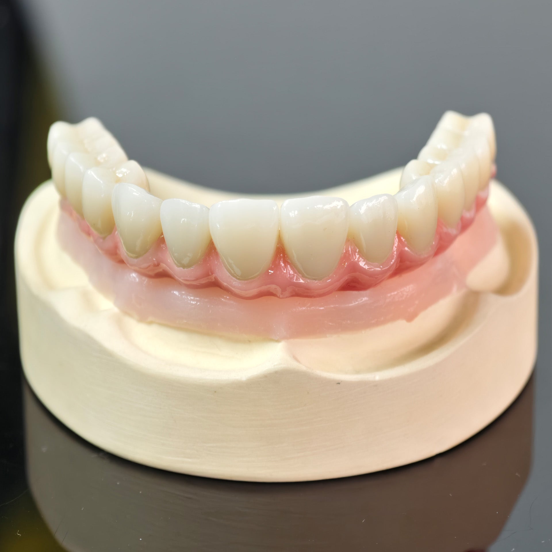 Malo Bridge With Gold-Plated Grade 5 Pure Titanium Malo Bridge