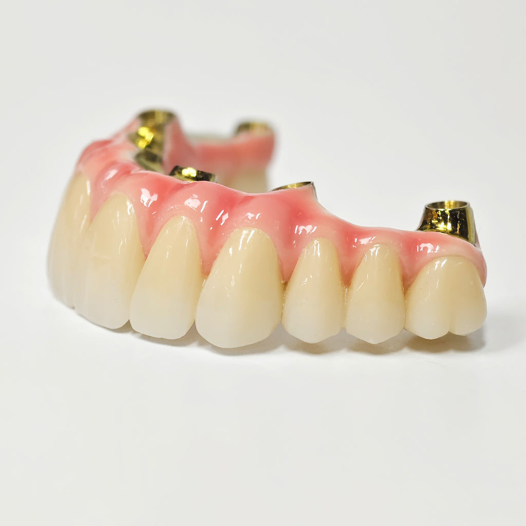 Malo Bridge With Gold-Plated Titanium Framework And A Gold Crown