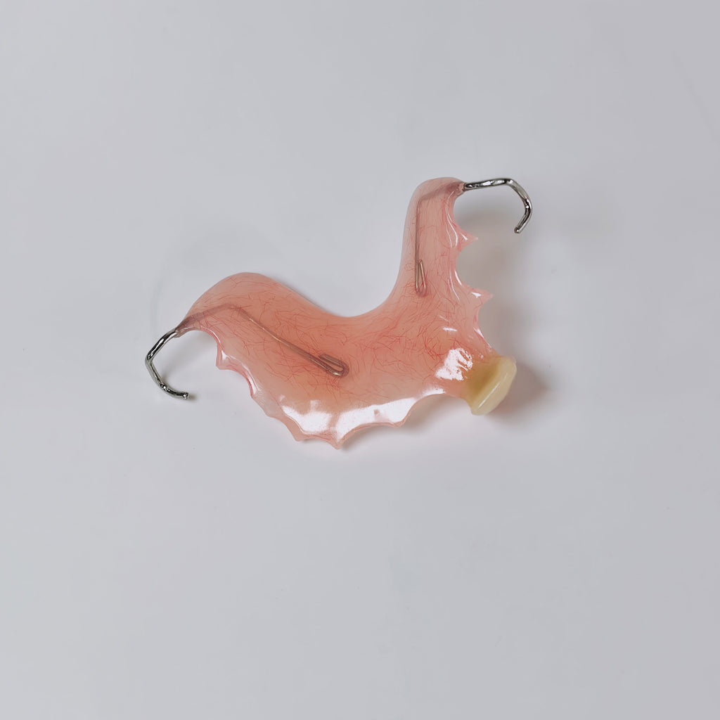 Metal Clasp Partial Denture
