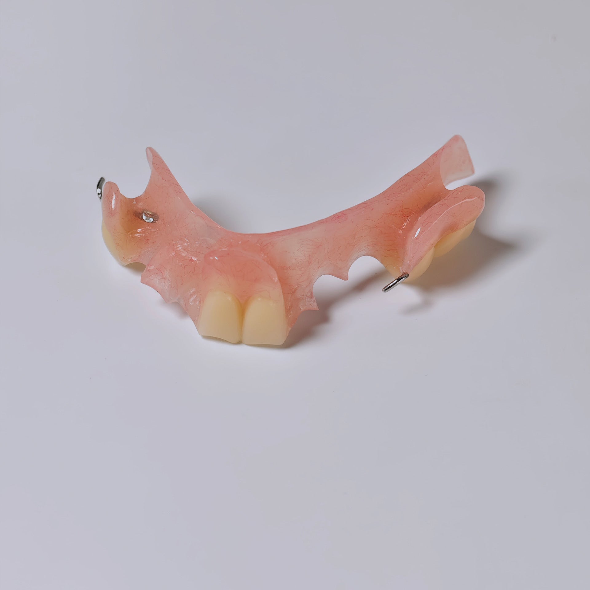 Metal Clasp Partial Denture