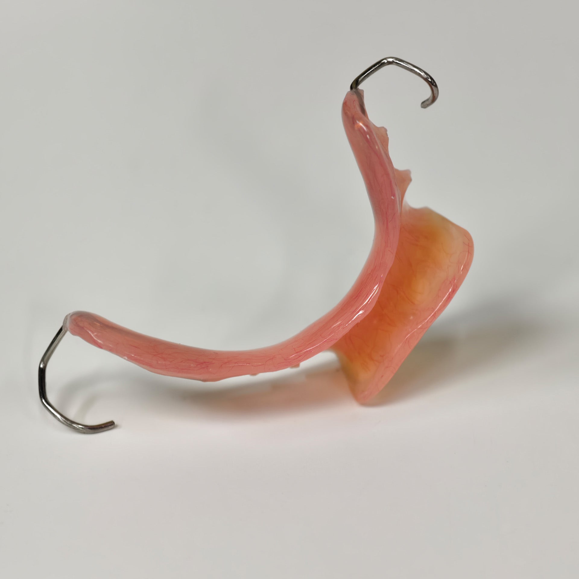 Metal Clasp Partial Denture