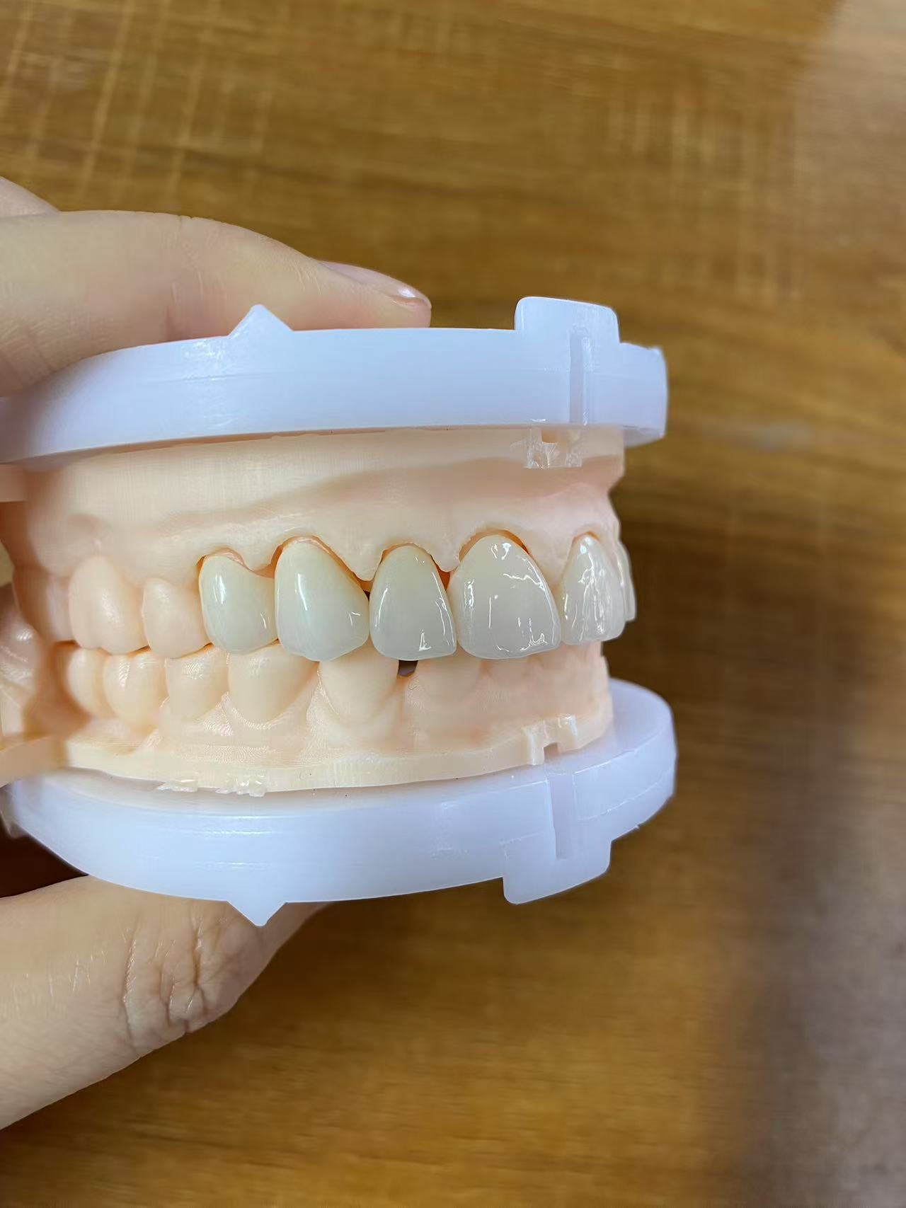 Multilayer Zirconia Crowns Aesthetic Shape Natural Shade Dental Crown