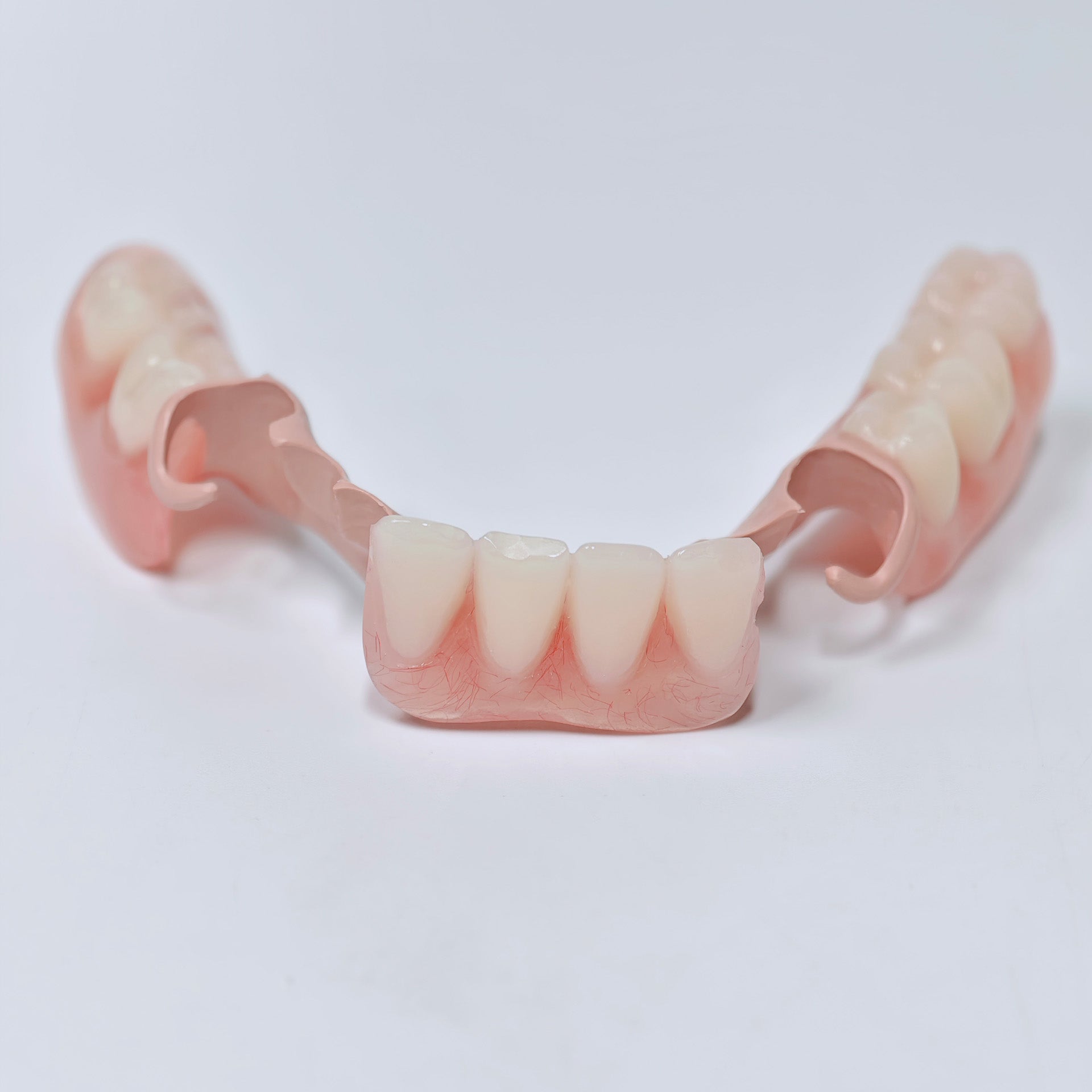 PEEK Framework Denture Metal Framework With Acrylic Denture