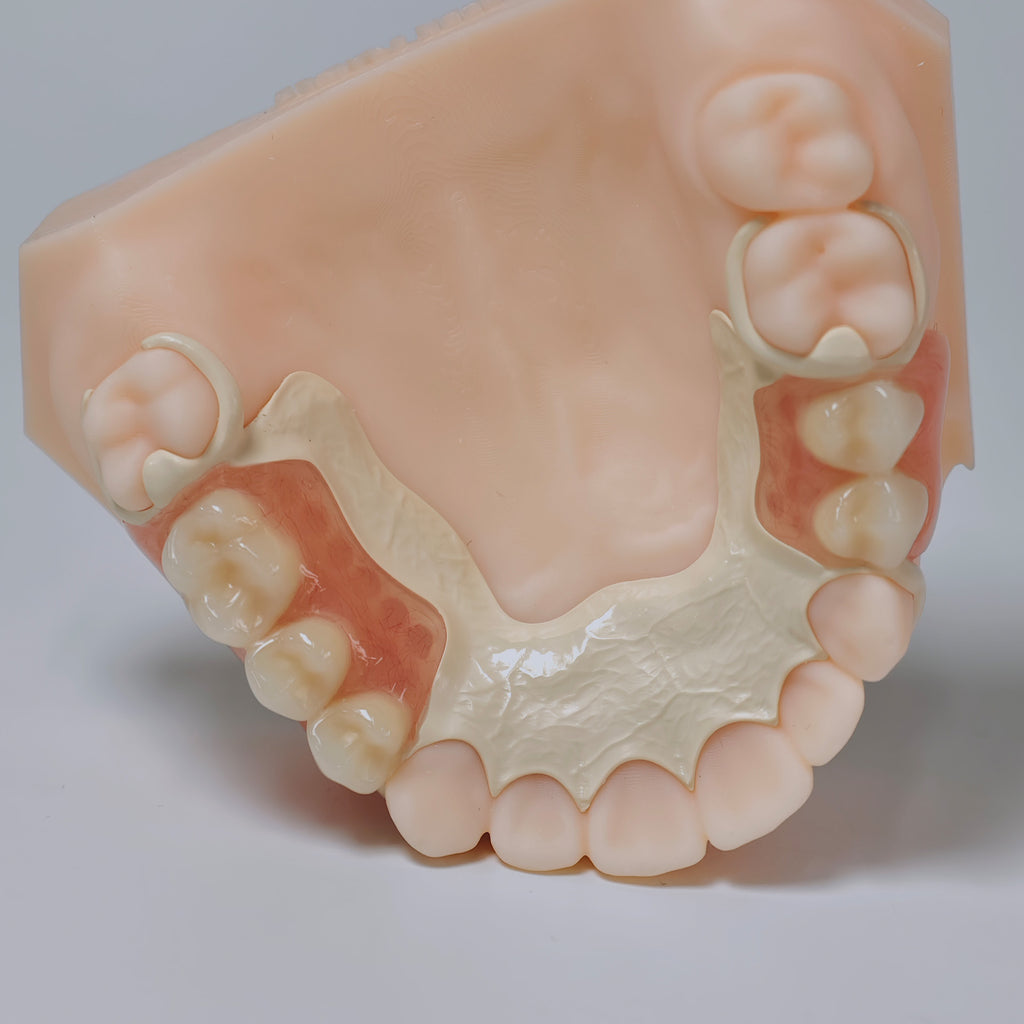 PEEK Framework Denture Metal Framework With Acrylic Denture