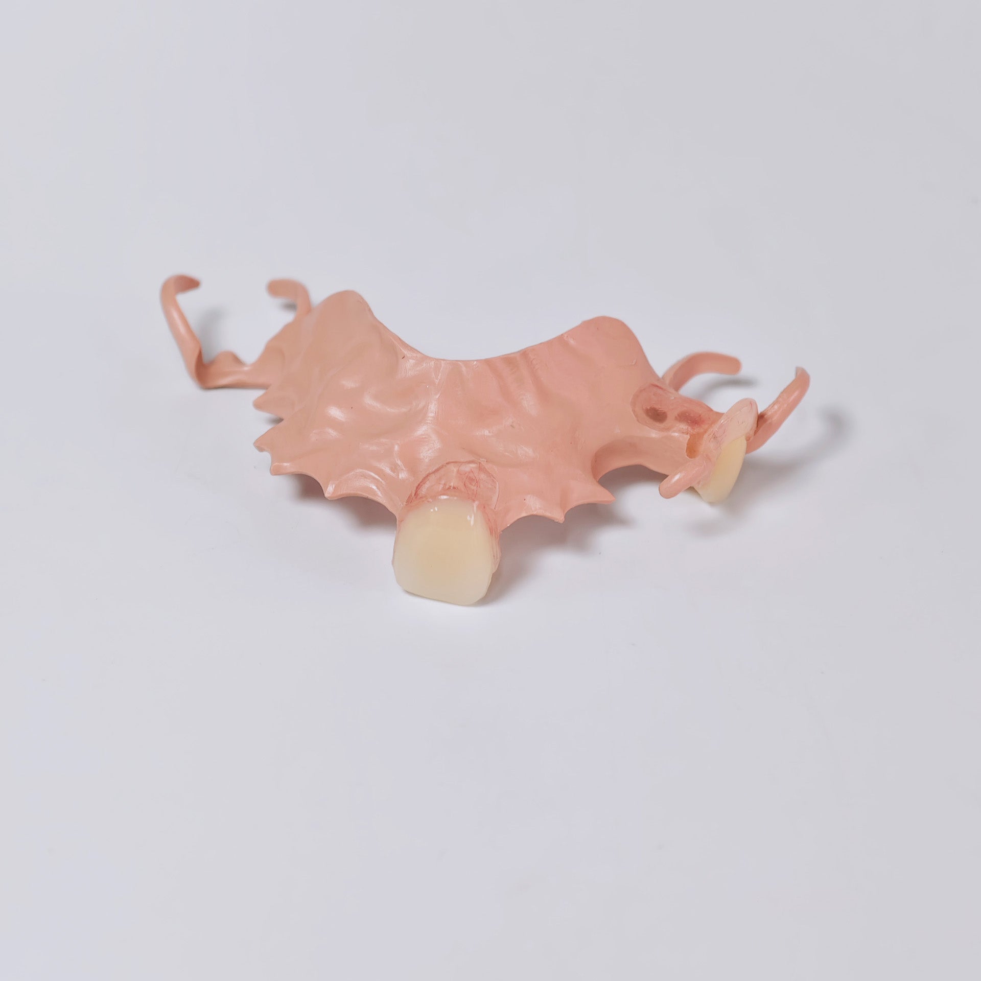 PEEK Framework Denture Metal Framework With Acrylic Denture