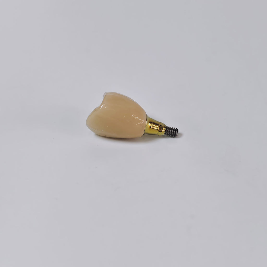 PFM Crown With Screw Retained