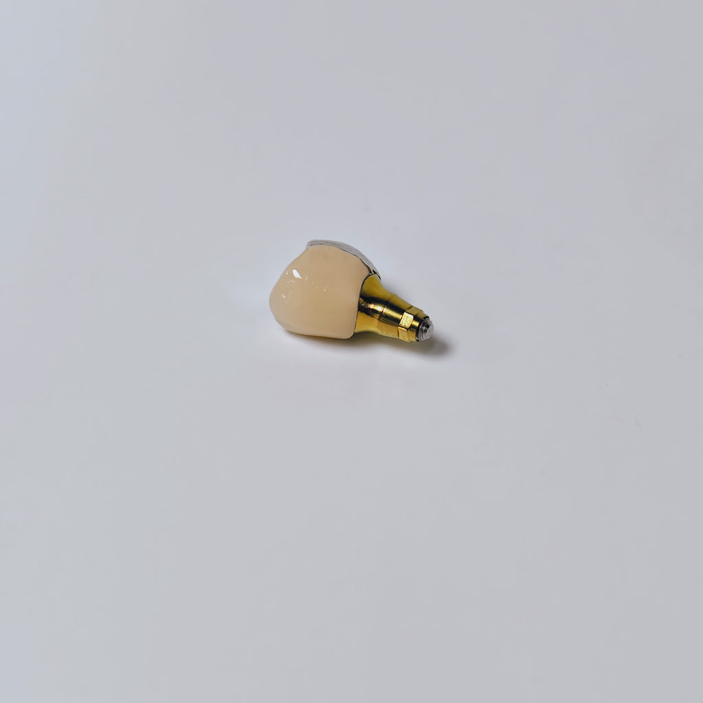 PFM Crown With Screw Retained