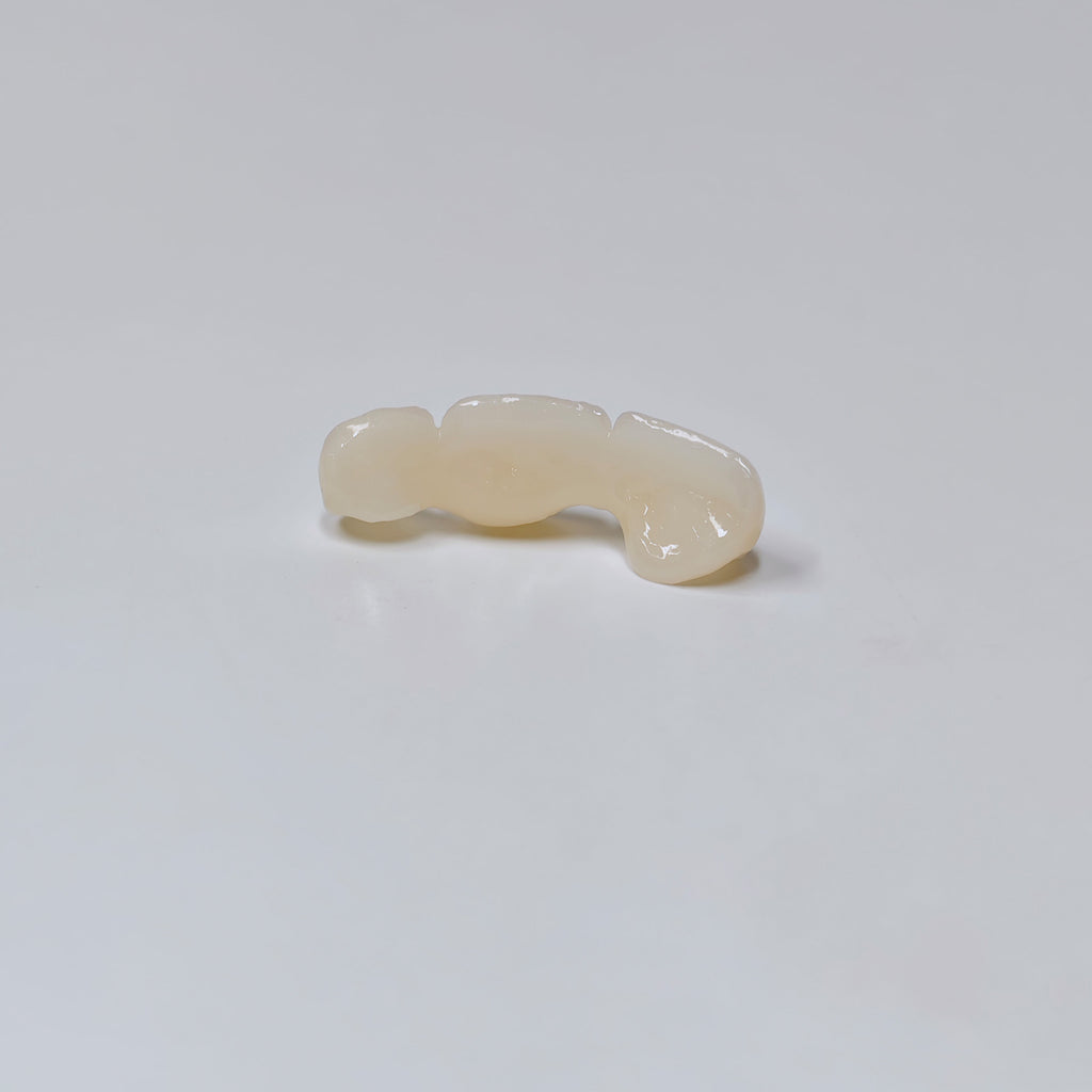 PFZ Dental Bridge – Depth And Aesthetics