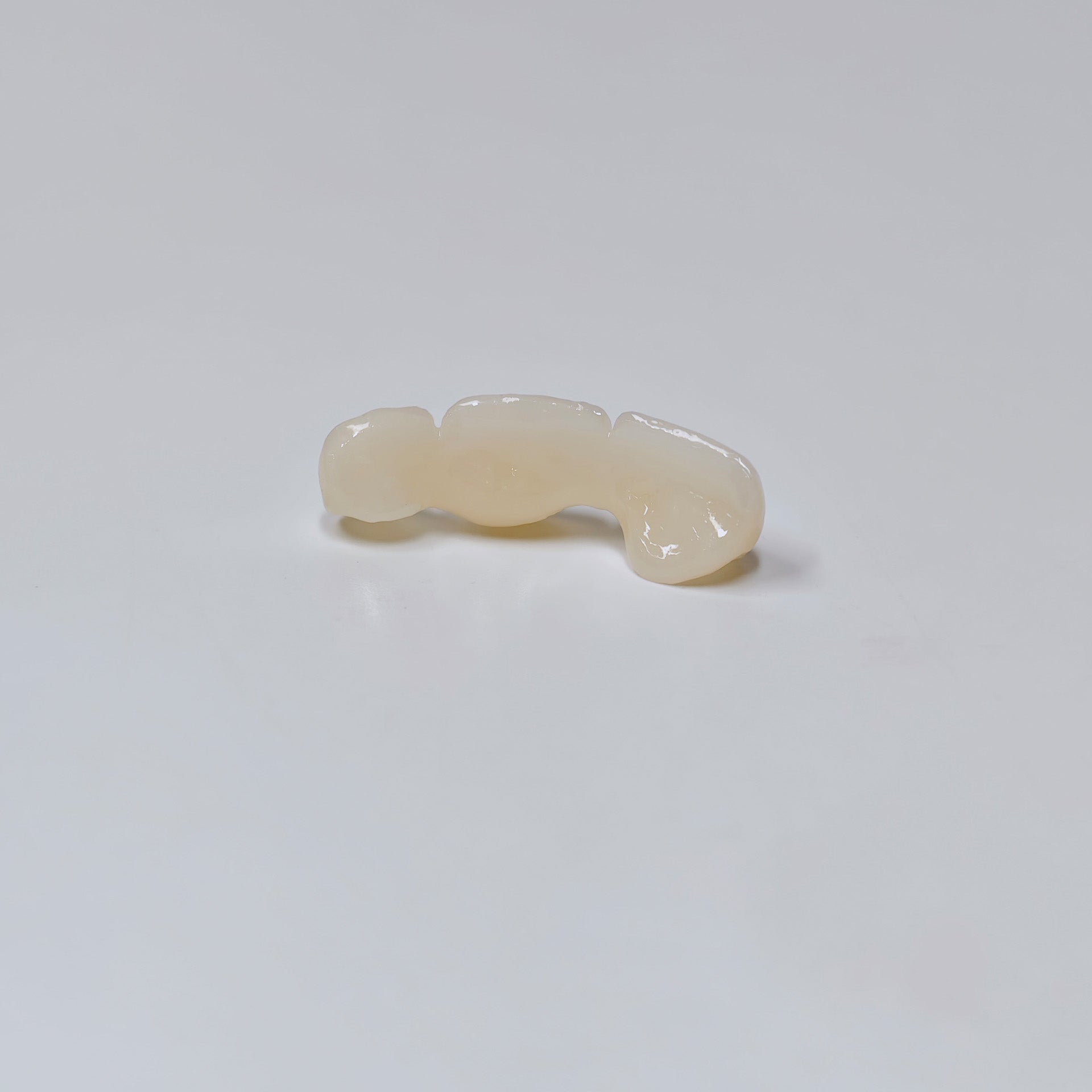 PFZ Dental Bridge – Depth And Aesthetics