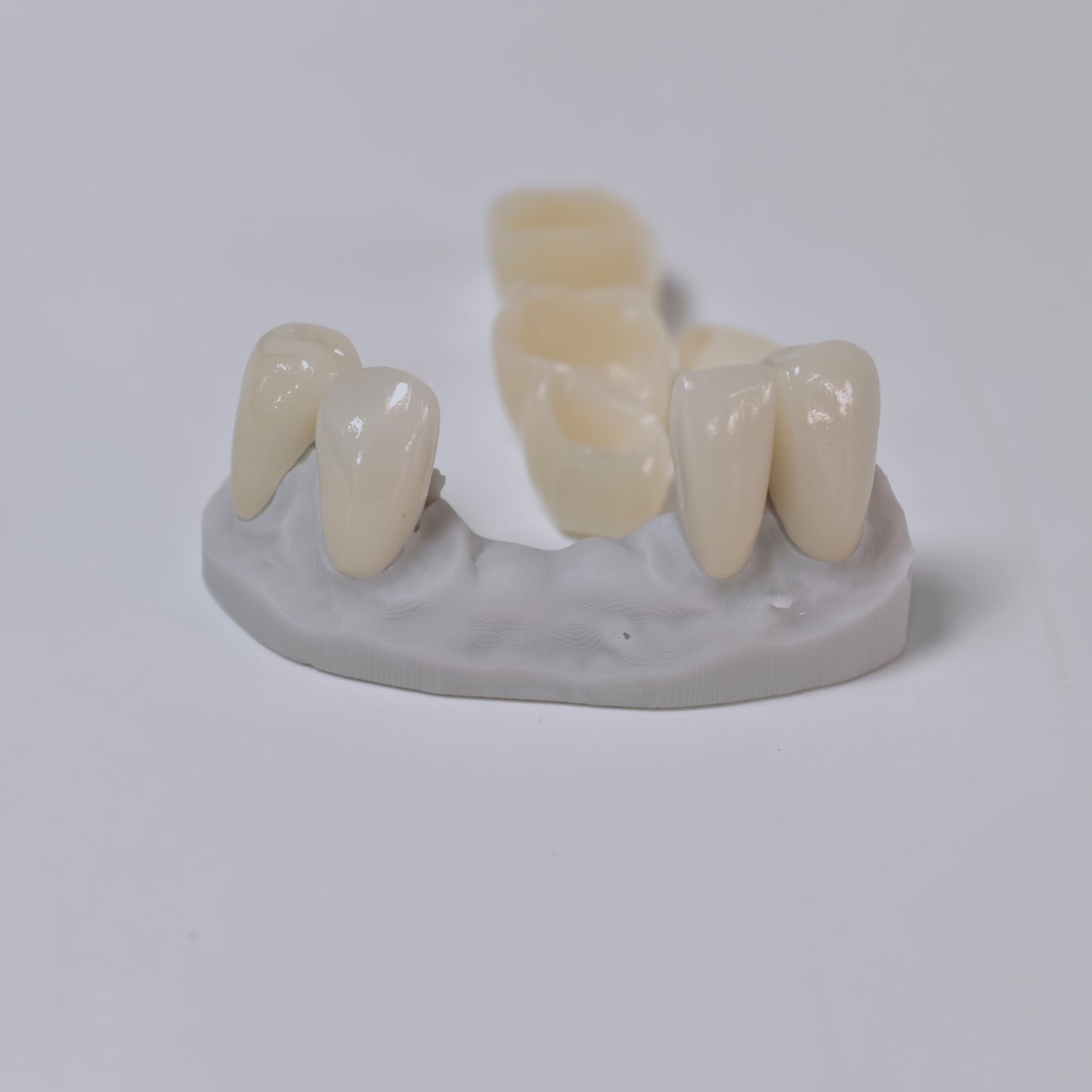 PFZ Porcelain Fused Zirconia Aidite Zirconia