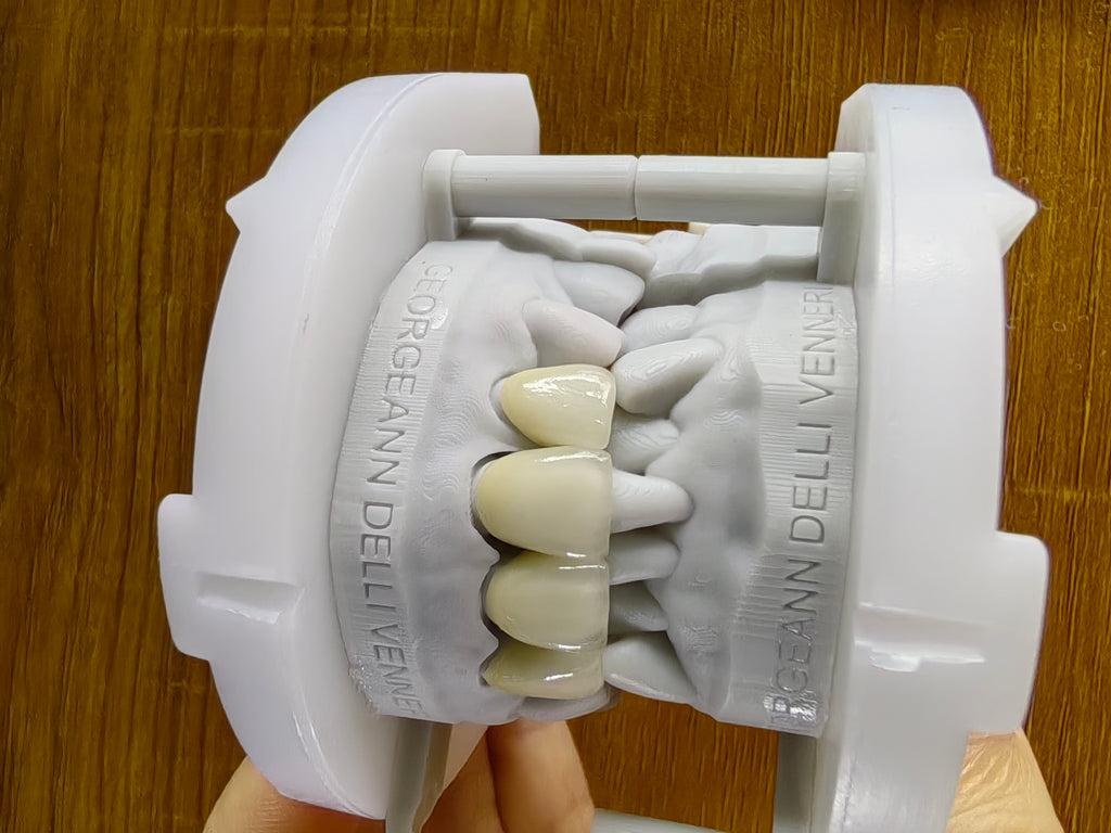 PFZ With Transparent In Incisal