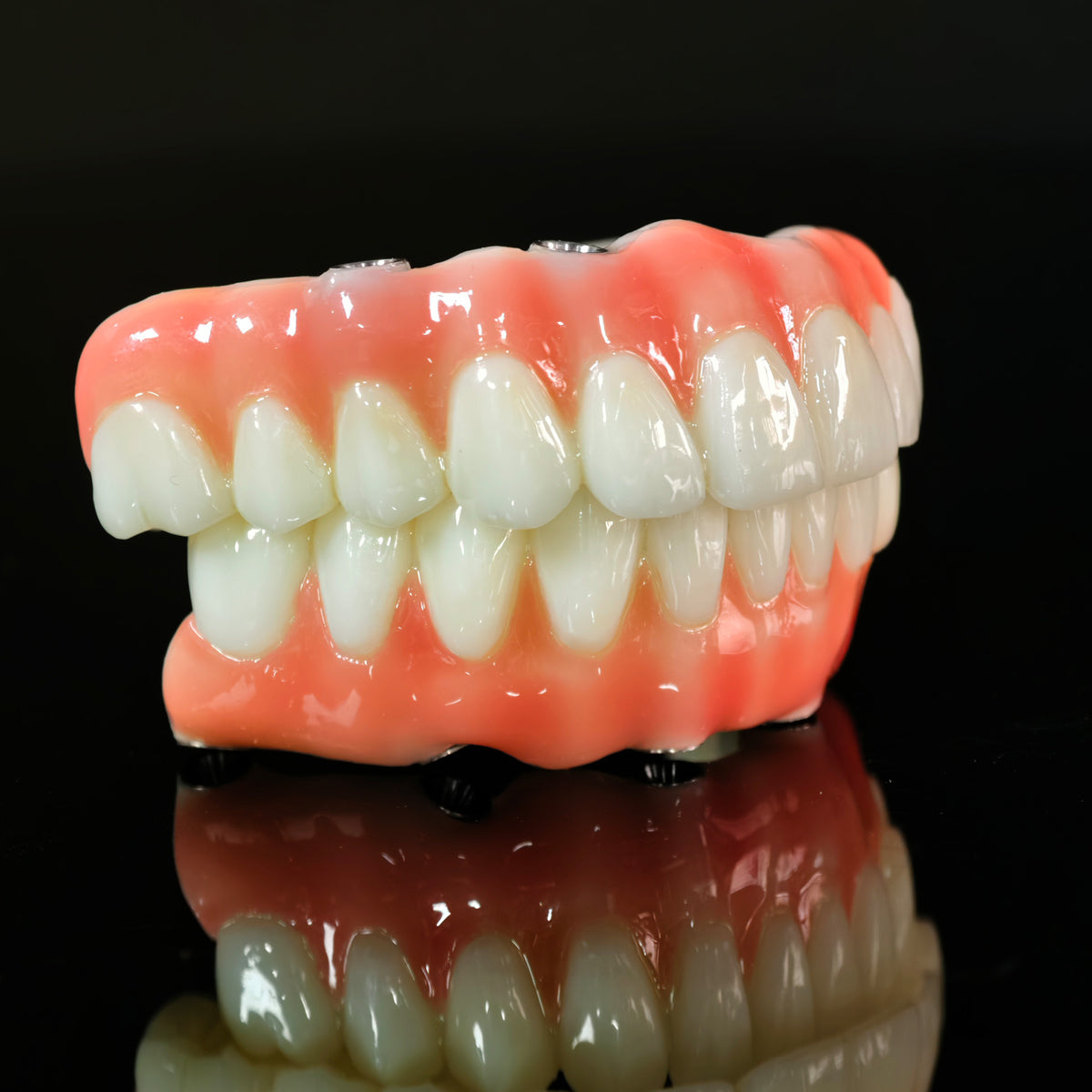 PMMA Bridge With Ti-Base Screw Retained Trying For Full Arch Restoration