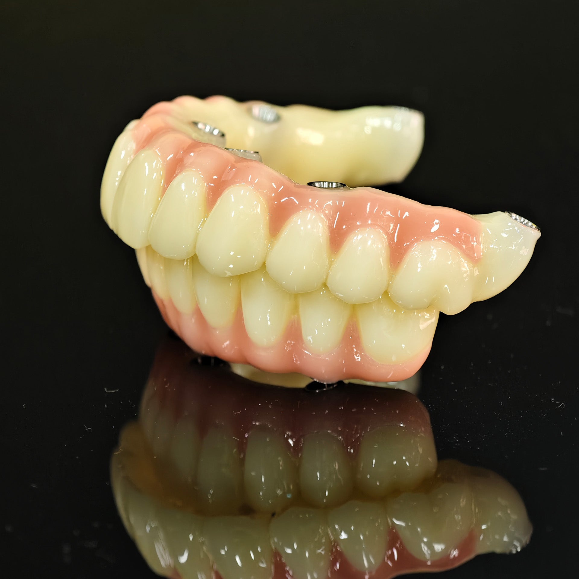 PMMA Bridge With Ti-Base Screw Retained Trying For Full Arch Restoration