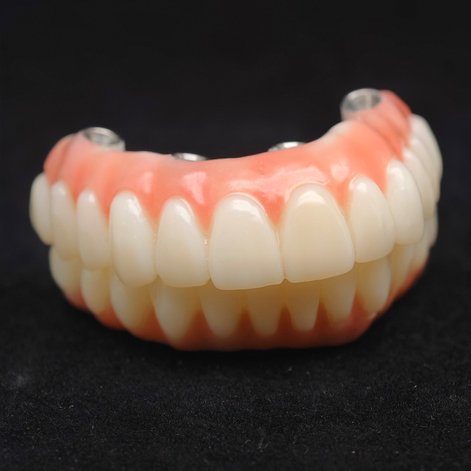 PMMA Bridge With Ti-Base Screw Retained Trying For Full Arch Restoration
