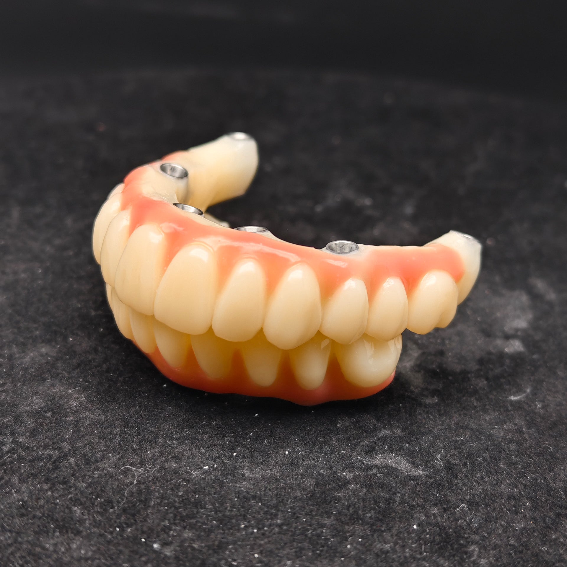PMMA Bridge With Ti-Base Screw Retained Trying For Full Arch Restoration