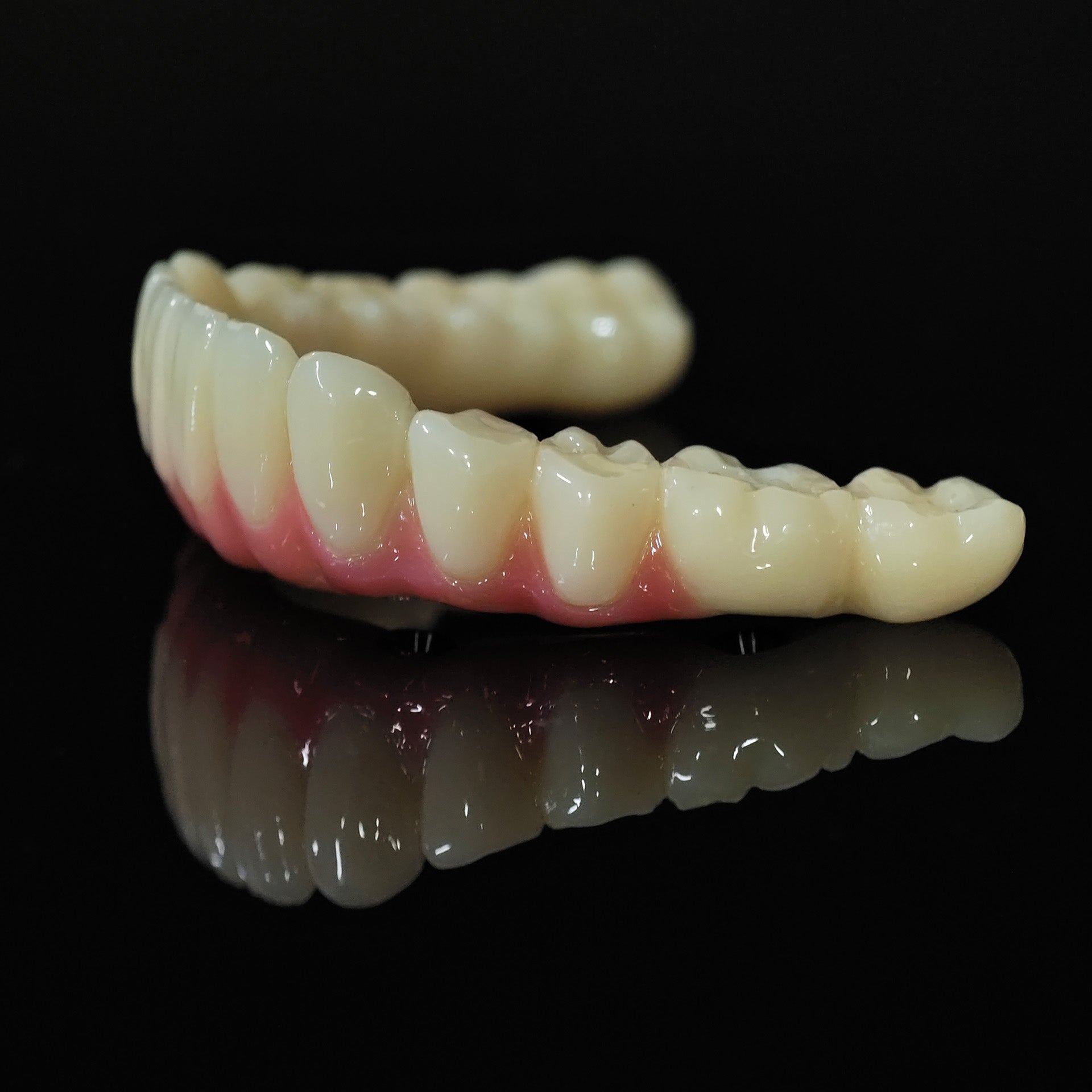 PMMA Bridge With Ti-Base Screw Retained Trying For Full Arch Restoration