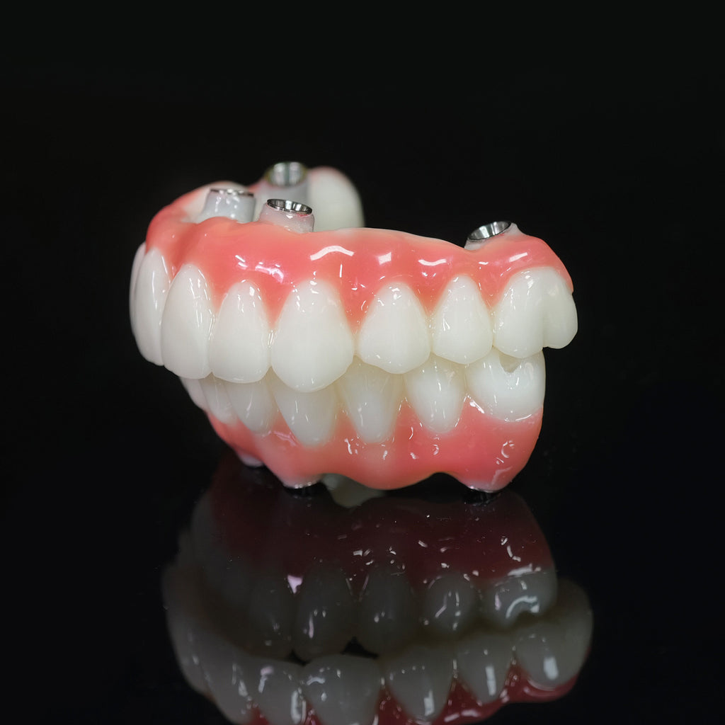 PMMA Bridge With Ti-Base Screw Retained Trying For Full Arch Restoration