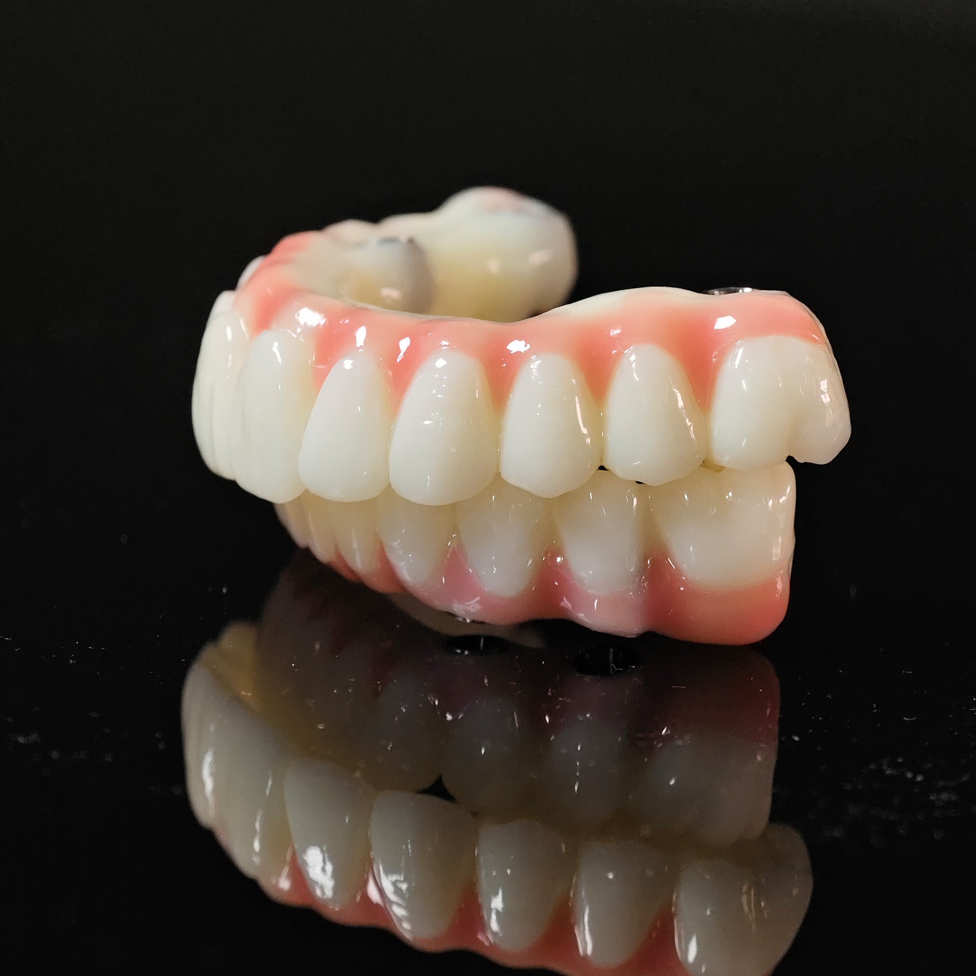 PMMA Bridge With Ti-Base Screw Retained Trying For Full Arch Restoration