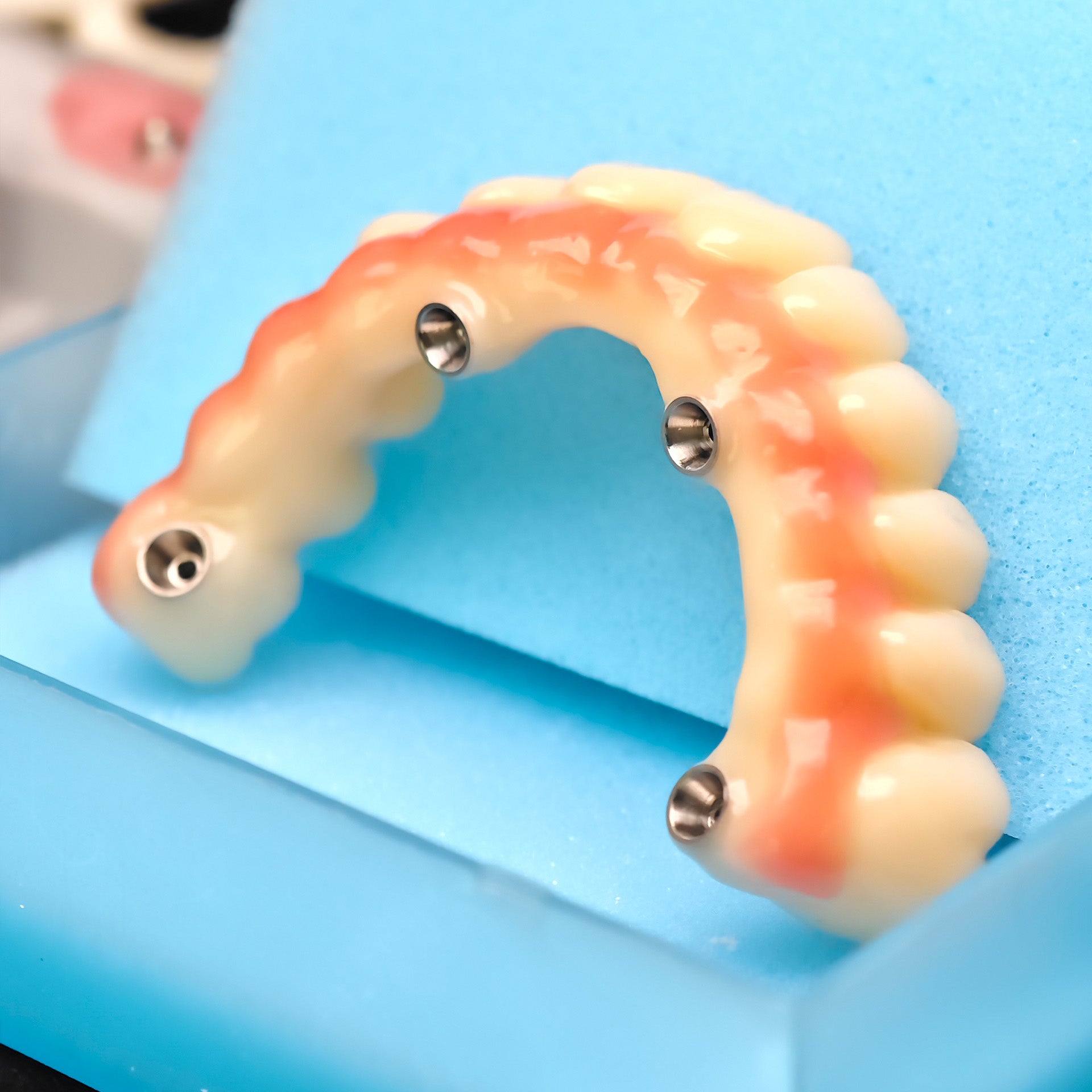 PMMA Bridge With Ti-Base Screw Retained Trying For Full Arch Restoration