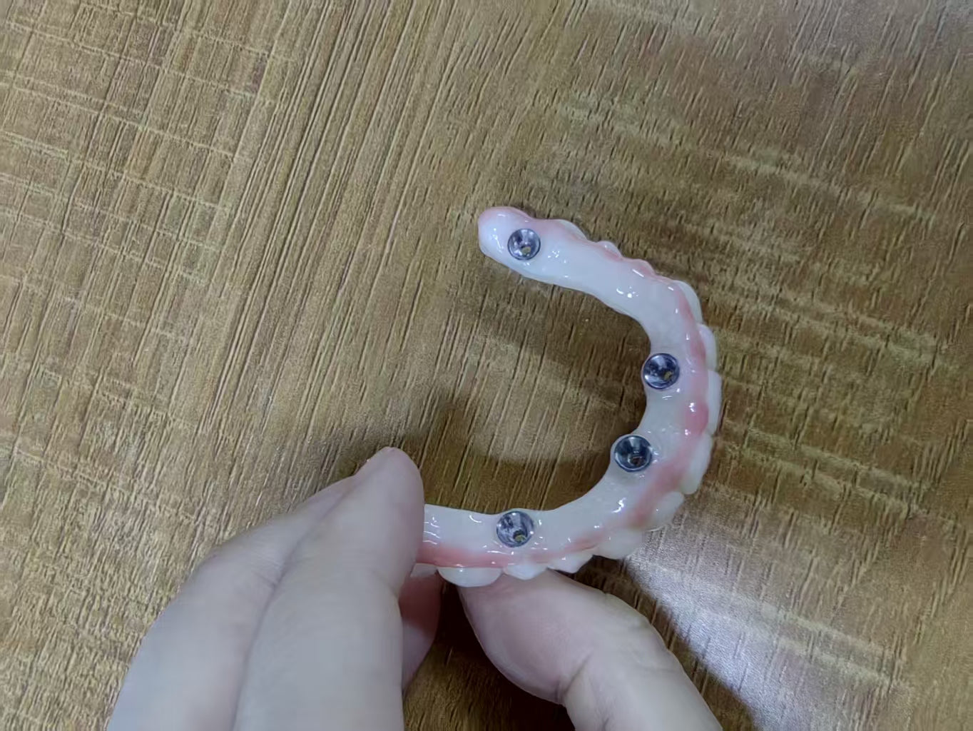 PMMA Bridge With Ti-Base Screw Retained Trying For Full Arch Restoration