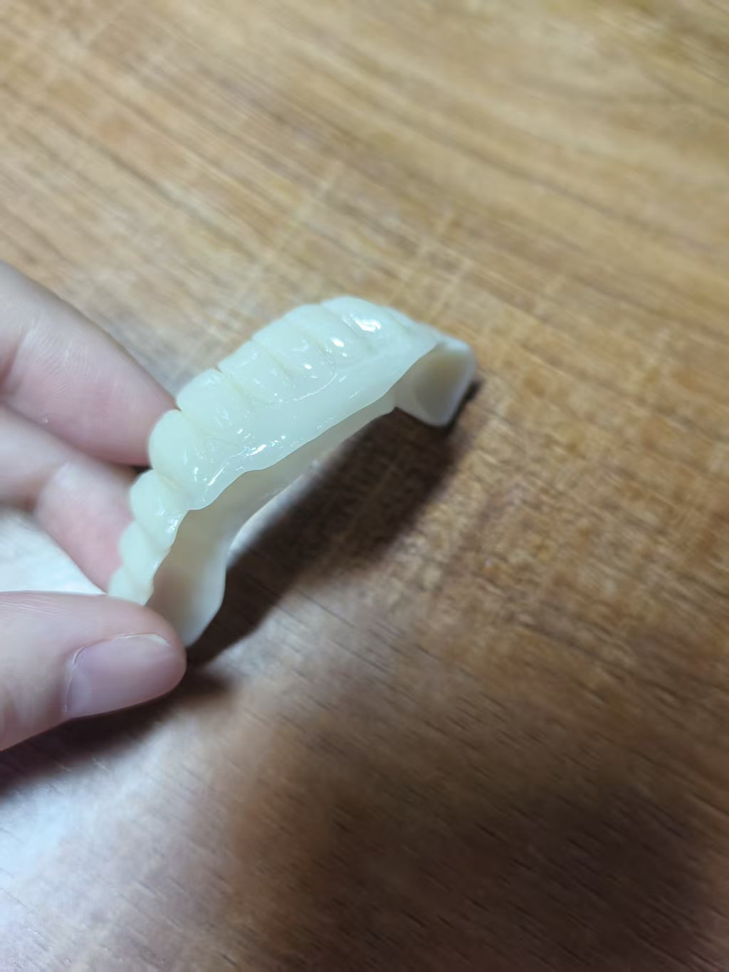 PMMA Bridge With Open Shell Preparing For Full Arch Dental Implants