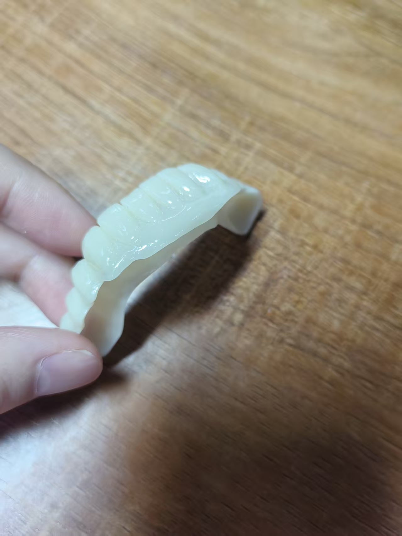 PMMA Bridge With Open Shell Preparing For Full Arch Dental Implants