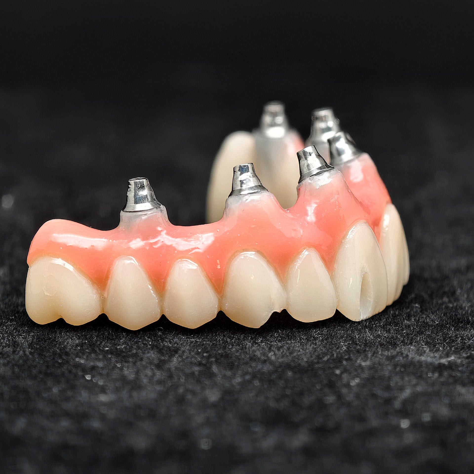 Pmma Bridge With Screw-Retained
