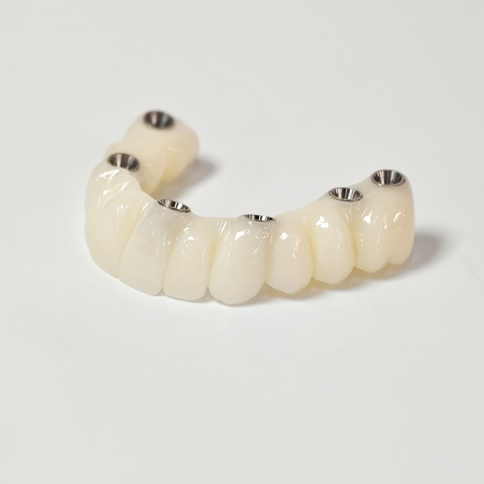 PMMA Bridge With Screw Retained