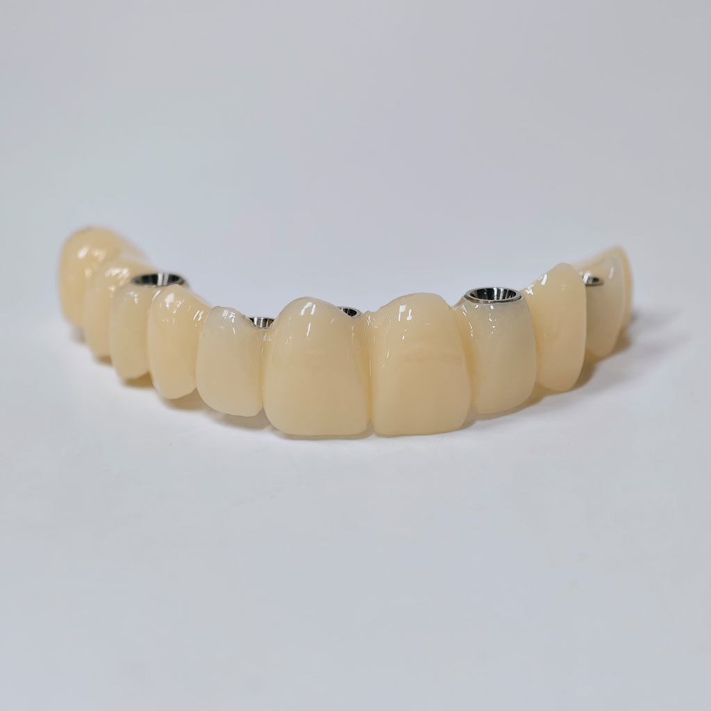 PMMA Bridge With Screw Retained