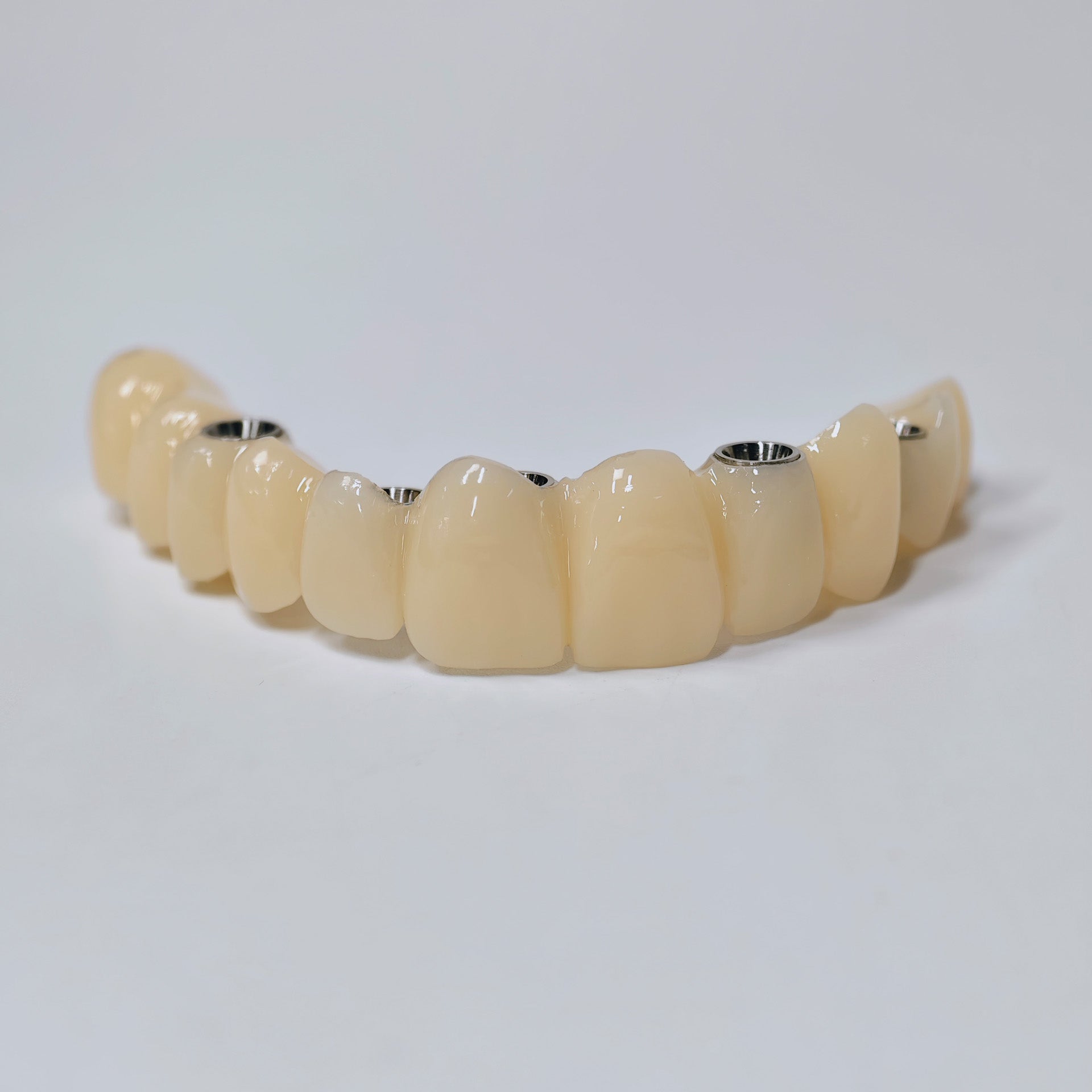 PMMA Bridge With Screw Retained