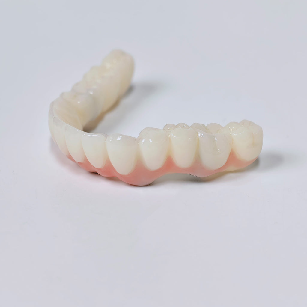 PMMA Bridge With Screw Retained