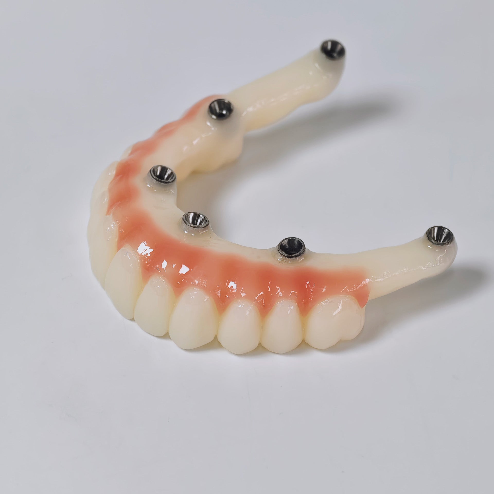 PMMA Bridge With Screw Retained
