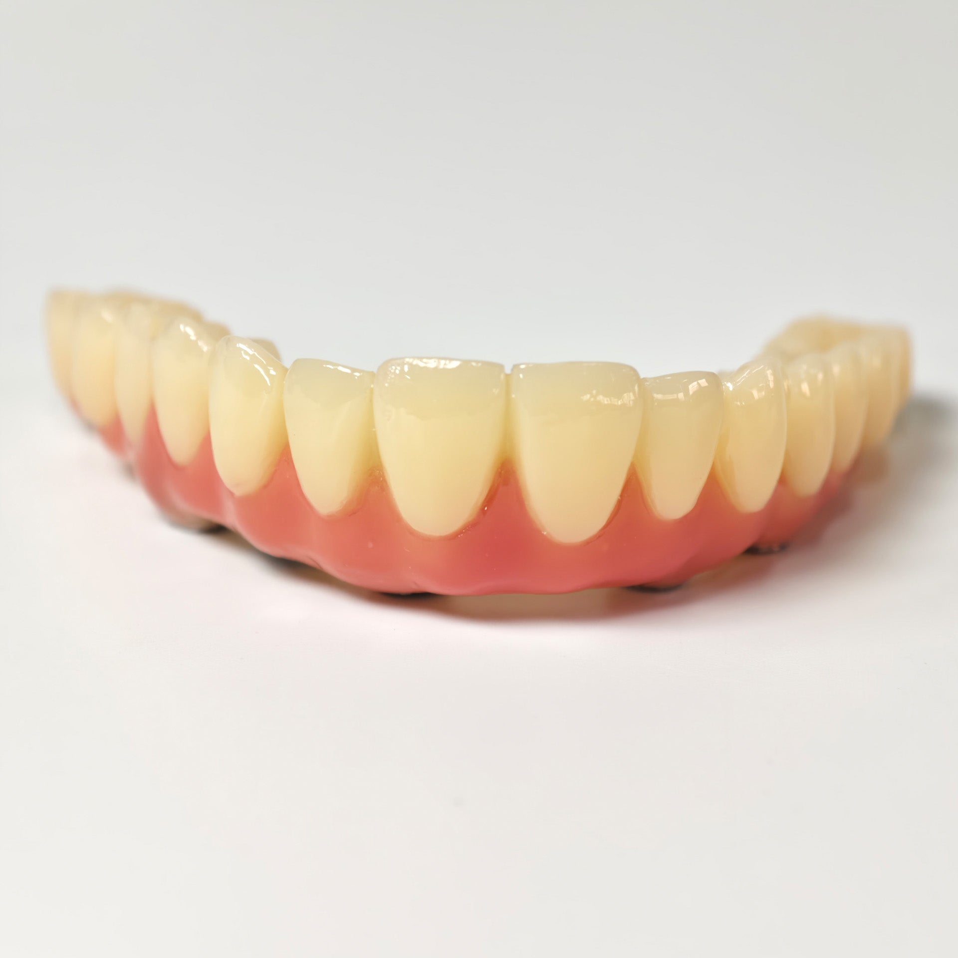 PMMA Bridge With Screw Retained