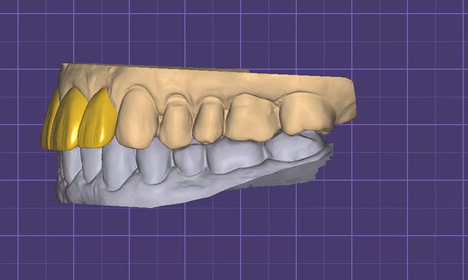 Regular Crown Design