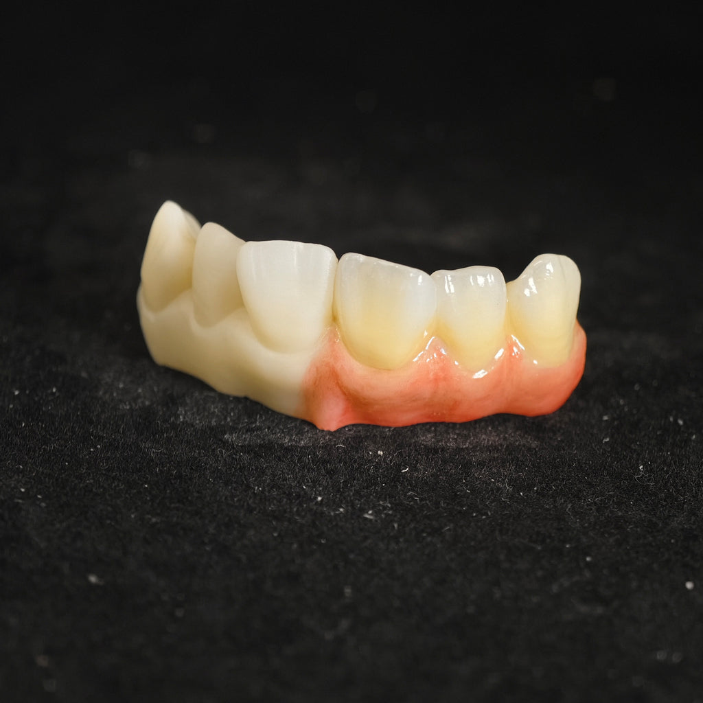 Ti-Bar Pure Titanium Metal Frame With Zirconia Bridge
