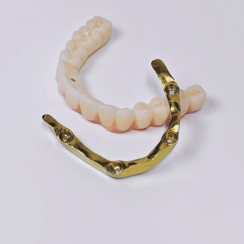 Ti-Bar Titanium Gold-Plated Metal Frame With Zirconia Bridge And Screw Retained
