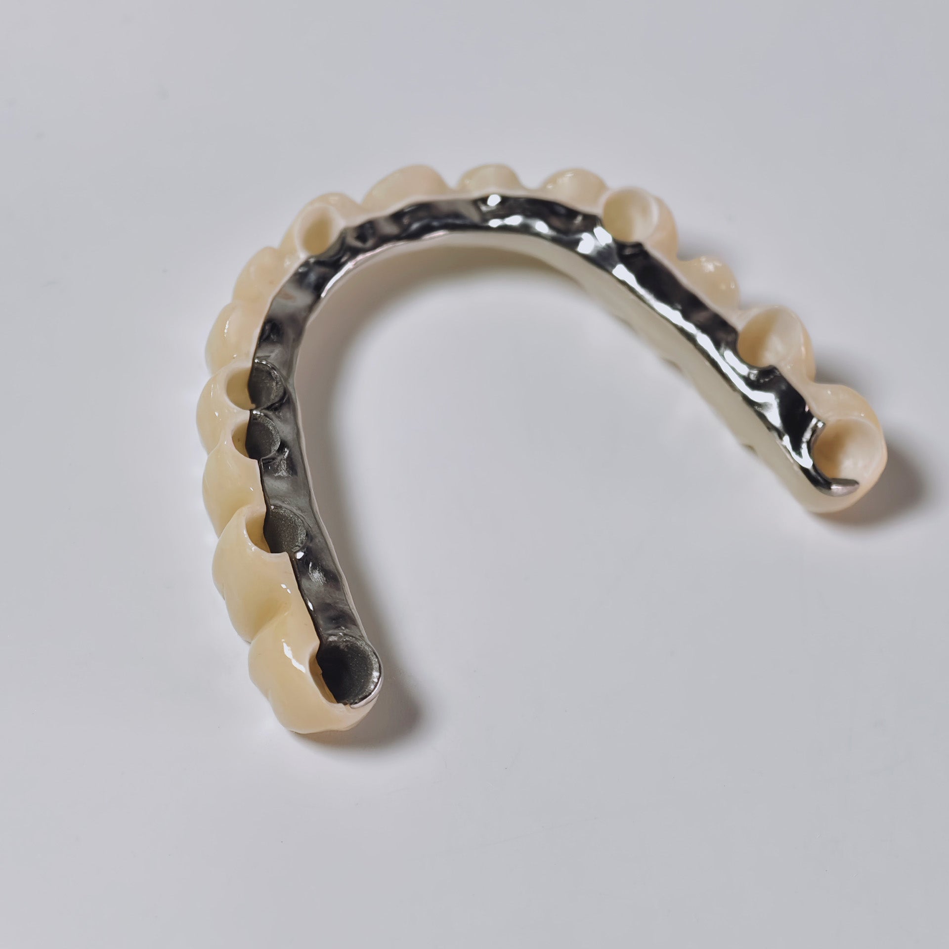 Ti-Bar Titanium Nitride Metal Frame With Zirconia Bridge And Cement Retained