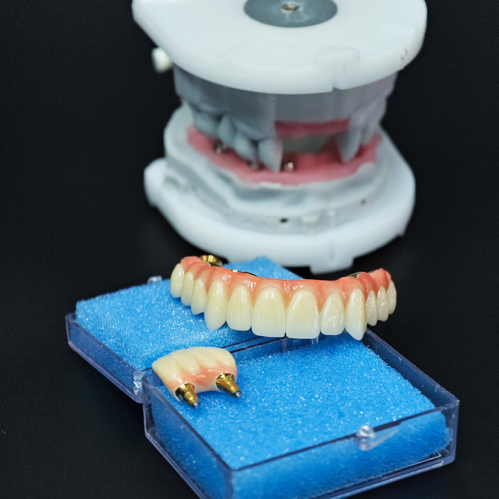 Ti-Bar Titanium Nitride Metal Frame With Zirconia Bridge For Full Arch Restoration