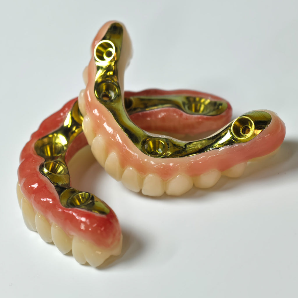 Ti-Bar Titanium Nitride Metal Frame With Zirconia Bridge For Full Arch Restoration