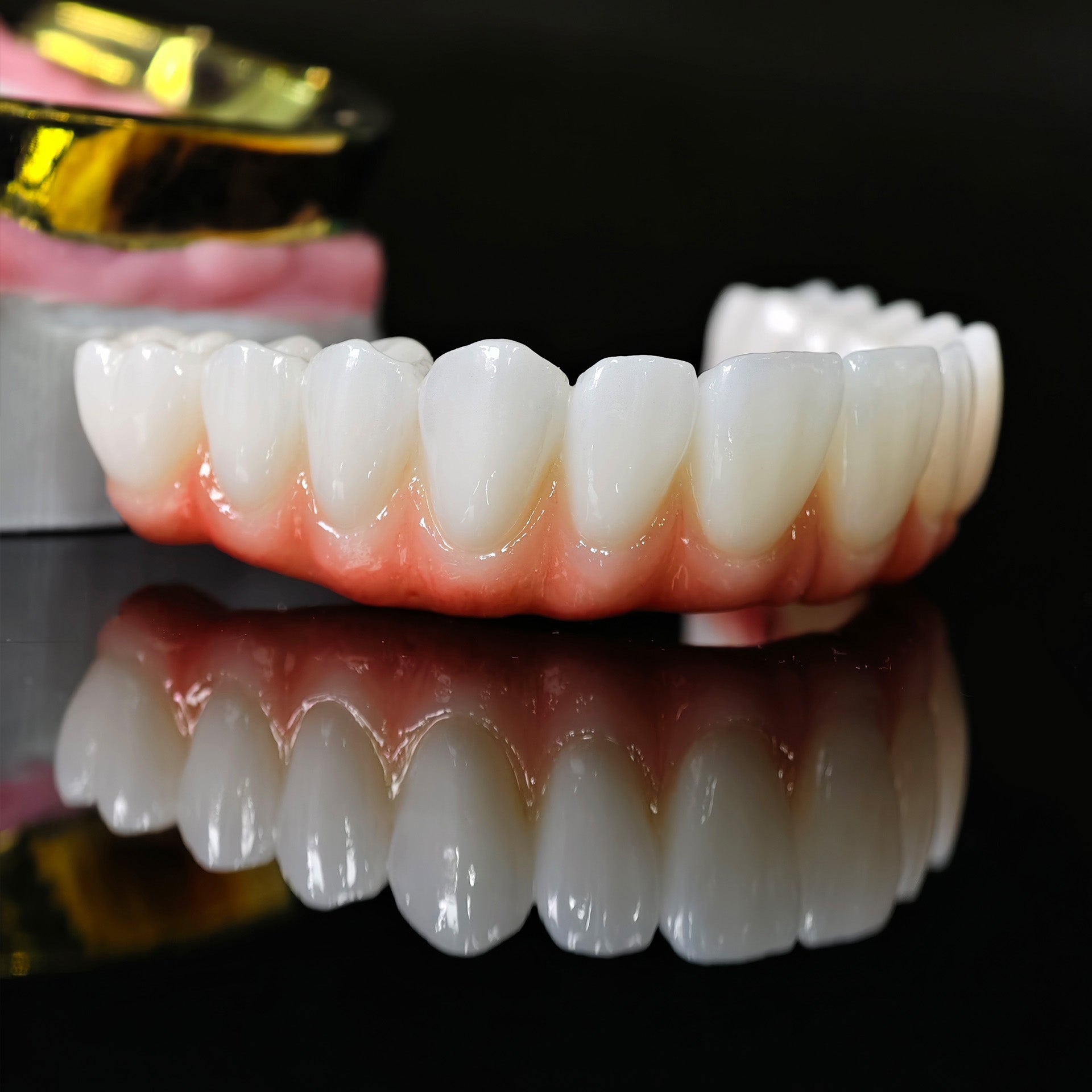Ti-Bar Titanium Nitride Metal Frame With Zirconia Bridge For Full Arch Restoration