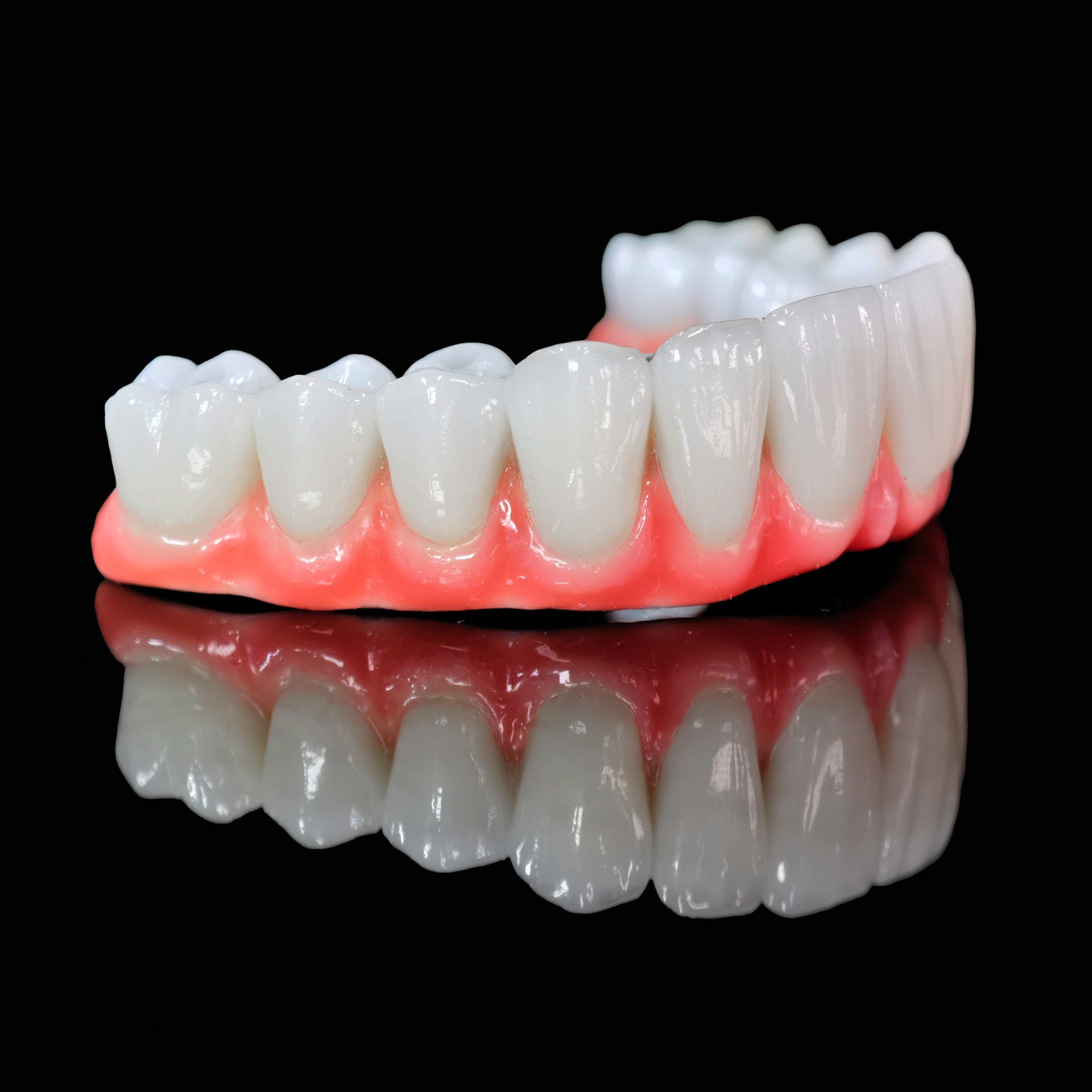 Traditional Malo Bridge With Alloy Framework Covering The Gingiva