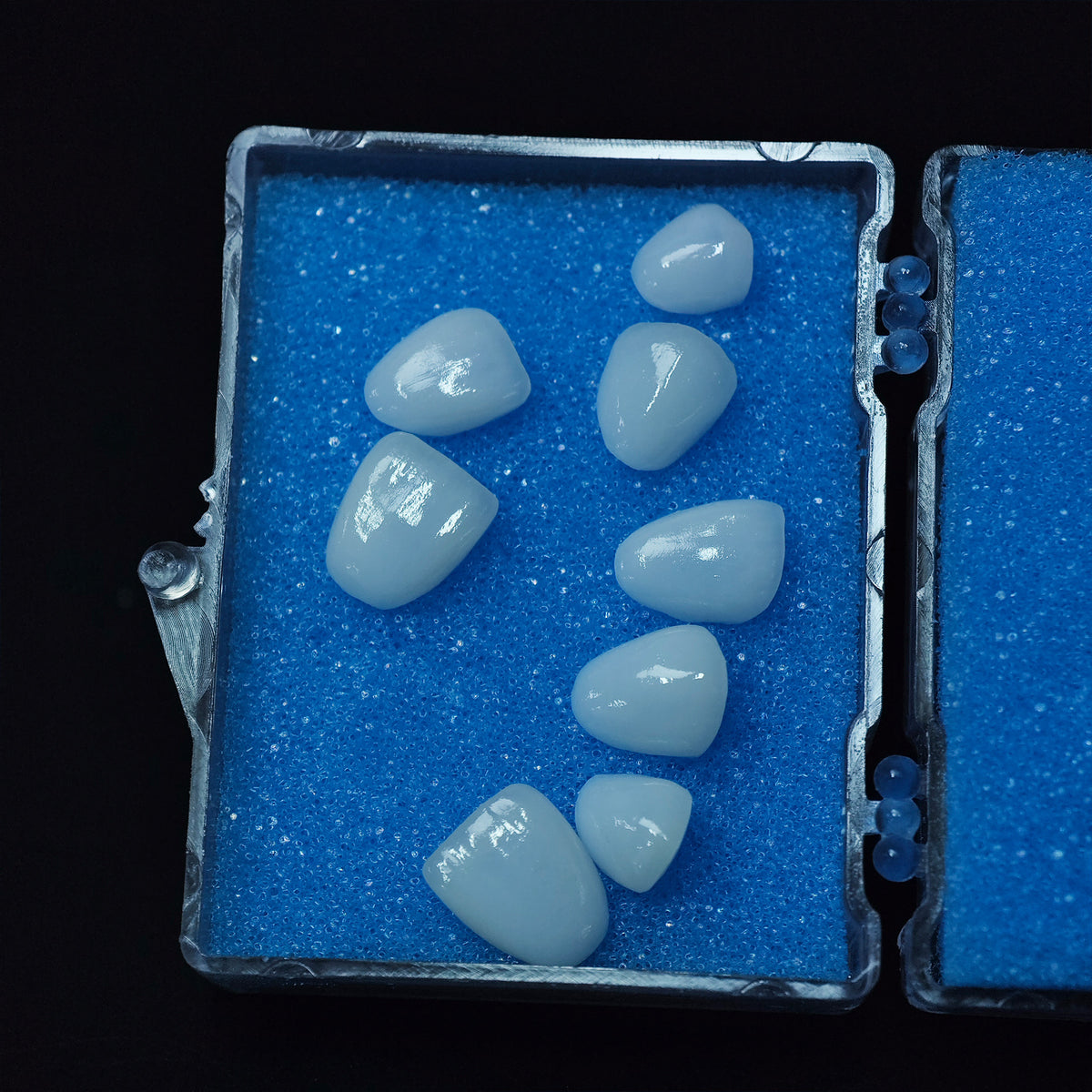 Ultra-Thin Emax Veneer. High Transparency/Translucent, Natural Shade