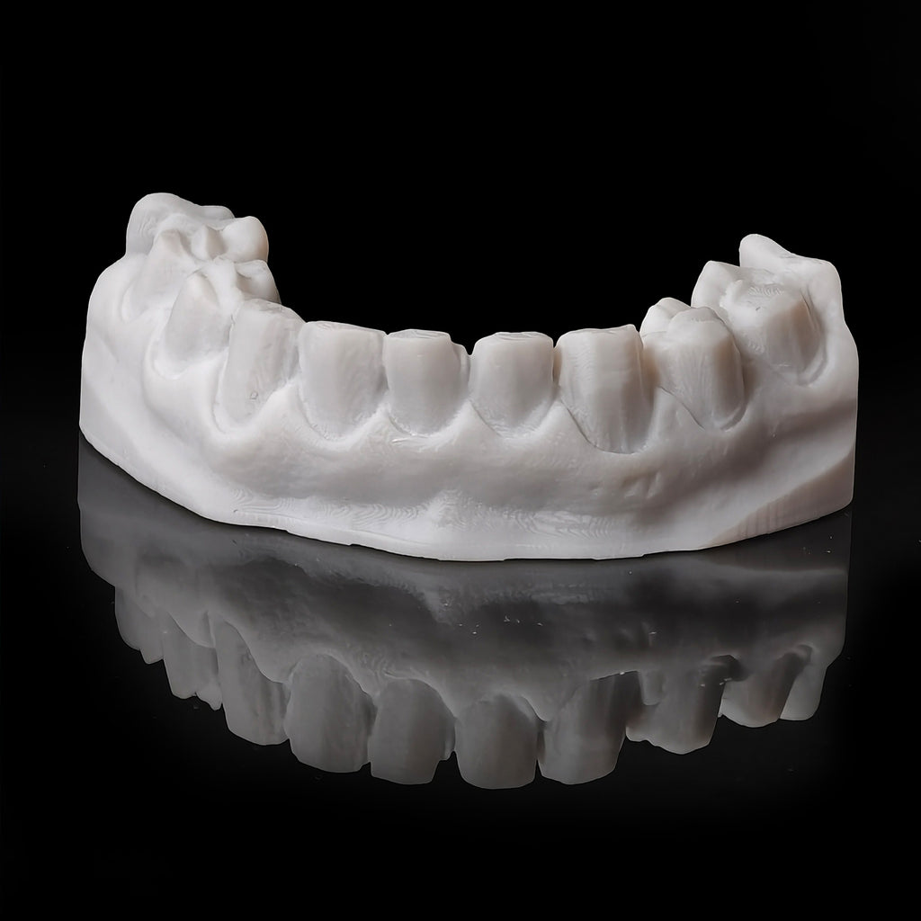 Ultra-Thin Emax Veneer. High Transparency/Translucent, Natural Shade