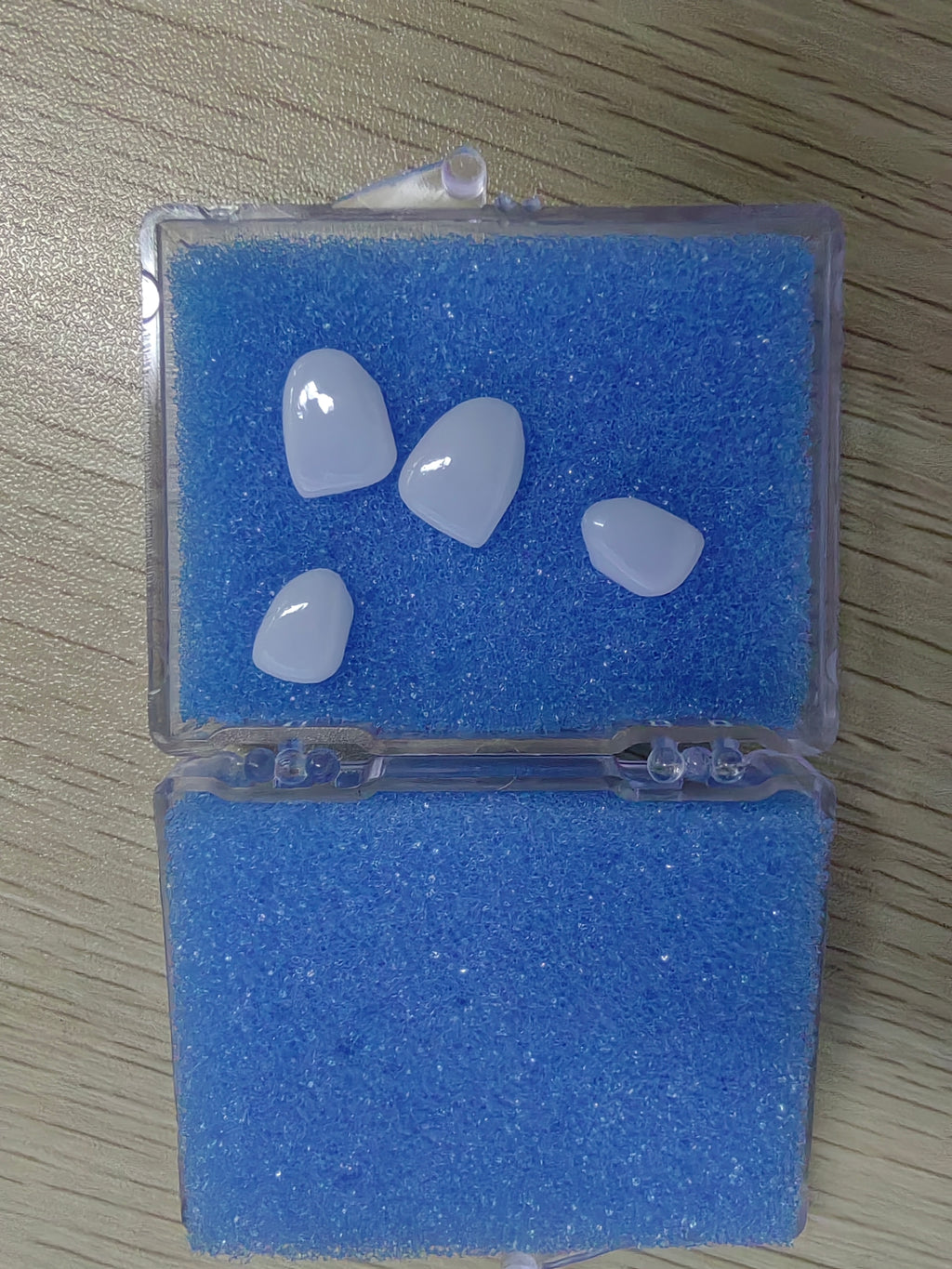 Ultra-Thin Emax Veneer. High Transparency/Translucent, Natural Shade